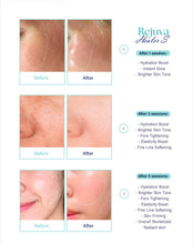 Load image into Gallery viewer, Rejuva Healers S – PDRN NAD+ & HA - 3 x 2.5ml