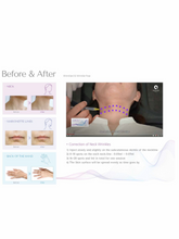 Load image into Gallery viewer, RACV Plus Collagen Filler - 1ml x 1