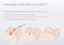 Load image into Gallery viewer, RACV Plus Collagen Filler - 1ml x 1