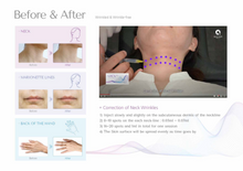 Load image into Gallery viewer, RACV Plus Collagen Filler - 1ml x 1