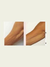 Load image into Gallery viewer, PB Serum Lift - 2 vials/Set