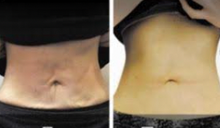 Load image into Gallery viewer, PB Serum Lift - 2 vials/Set