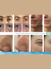 Load image into Gallery viewer, AMI EYES PN 1% - 2 ml