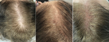 Load image into Gallery viewer, Nucleofill Hair 2% - 2ml