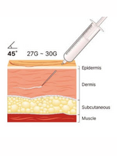 Load image into Gallery viewer, Reparden PN - 2ml x 3 syringes