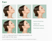 Load image into Gallery viewer, Reparden HA - 2ml x 1 syringes