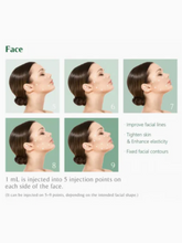 Load image into Gallery viewer, Reparden HA - 2ml x 1 syringes