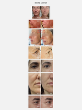 Load image into Gallery viewer, Pepplus+ Super Lifting Mask Set - 10 Masks, Cream 30ml (10 Treatments) - aesthetic-essentials