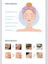 Load image into Gallery viewer, Manla Kar - 1 x 1.0ml, Collagen Treatment