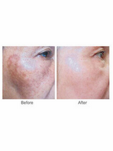 Load image into Gallery viewer, Cindella Whitening Treatment 1200mg - 1 vial of each - aesthetic-essentials