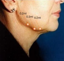 Load image into Gallery viewer, Light Fit - 10 vials x 2ml