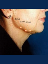 Load image into Gallery viewer, Light Fit - 10 vials x 2ml