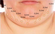 Load image into Gallery viewer, Light Fit - 10 vials x 2ml