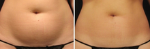 Load image into Gallery viewer, Triada Lipolytic (SLIM+, SMOOTH+, DRAIN+) - 3vials