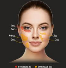 Load image into Gallery viewer, Etrobelle 200 PLA 170mg + HA 30mg, CE
