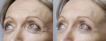 Load image into Gallery viewer, Dermaren Lumi Eyes - 1 x 1ml