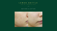 Load image into Gallery viewer, Lemon Bottle Skin Booster - 6 x 3.5ml