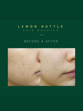 Load image into Gallery viewer, Lemon Bottle Skin Booster - 6 x 3.5ml