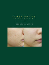 Load image into Gallery viewer, Lemon Bottle Skin Booster - 1 vial x 3.5ml