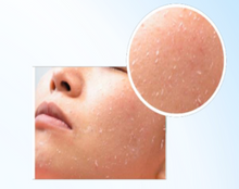 Load image into Gallery viewer, La PRECIA Soft Peel  (ACID FREE) - 35 g / 40 ml
