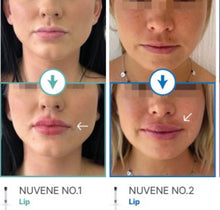 Load image into Gallery viewer, Nuvene No2 HA Filler (Hard) - 1ml x 1 syringe
