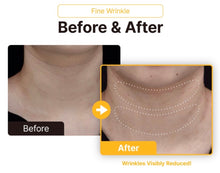 Load image into Gallery viewer, Nuvene Flex HA Filler - 2.7ml x 1 syringe
