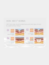 Load image into Gallery viewer, RACV Plus Collagen Filler - 1ml x 1
