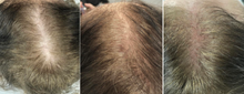 Load image into Gallery viewer, Nucleofill Hair 2% - 2ml
