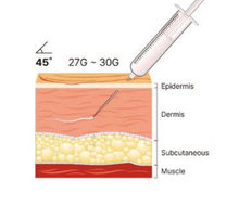 Load image into Gallery viewer, Reparden PN  - 2ml x 1 syringes (Without Box)
