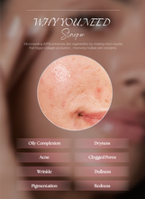 Load image into Gallery viewer, Starpen Skin Care Device (Auto MTS Solution)
