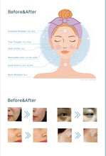 Load image into Gallery viewer, Manla Kar - 1 x 1.0ml, Collagen Treatment
